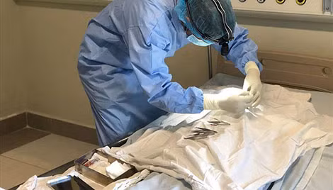 Doctor Nguyen Huu Hoang – Director of the Eye Bank performing necessary operation on Van Nhi for later cornea donation.