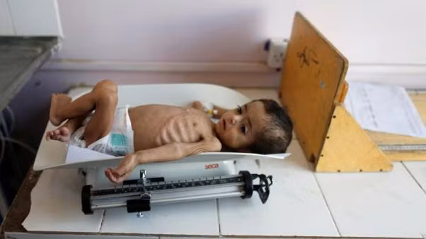 Yemen war a 'living hell' for children: UNICEF ảnh 1