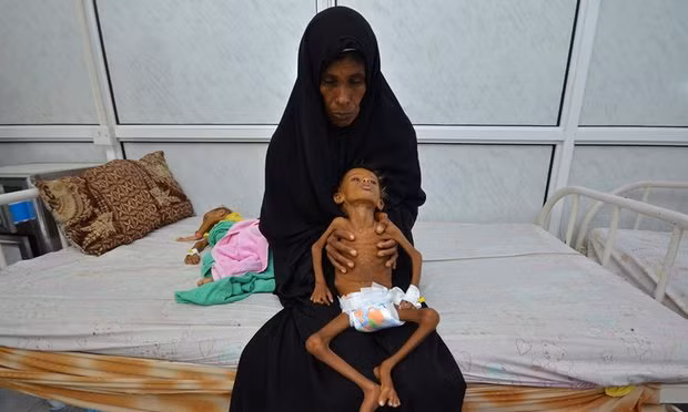 Six-year-old Salem Abdullah Musabih is held by his mother in an intensive care unit in the Red Sea port of Hodaida. Photograph: Abduljabbar Zeyad/Reuters