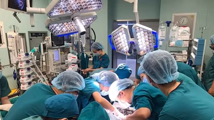HCM City's doctors successfully separate conjoined twins