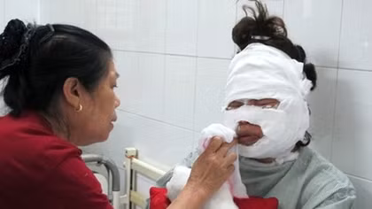 Party balloon explosion injures five in Vietnam, one hospitalize