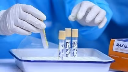 Vietnam detects 82 more COVID-19 infections