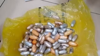 Senegalese man arrested for trafficking cocaine – in his stomach