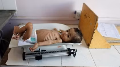 Yemen war a 'living hell' for children: UNICEF