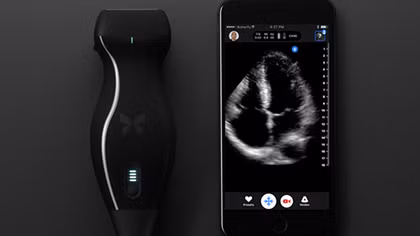 Doctor uses iPhone ultrasound device to diagnose his own cancer 