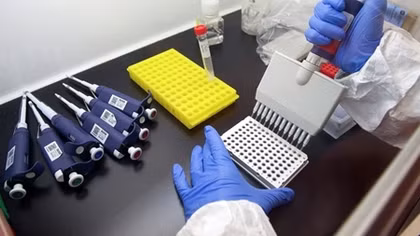Researchers discover potential Ebola virus antidote