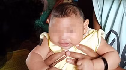 Vietnam confirms first Zika-tied birth defect case