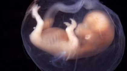 Embryo successfully born after being frozen for 24 years