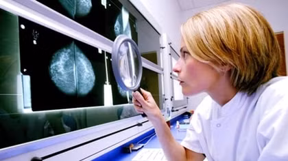 GPs could use breast cancer 'calculator' to predict risk to women
