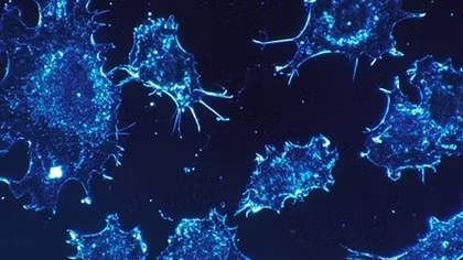 New Weapon: UK PM May to announce large investment in AI to fight cancer