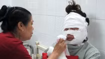 Party balloon explosion injures five in Vietnam, one hospitalize