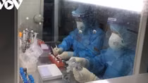 Local COVID-19 cases surge by 75, 106 patients given severe prognosis