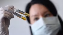 Plasma from coronavirus survivors found to help severely ill patients