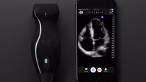Doctor uses iPhone ultrasound device to diagnose his own cancer 