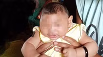 Vietnam confirms first Zika-tied birth defect case