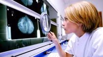 GPs could use breast cancer 'calculator' to predict risk to women