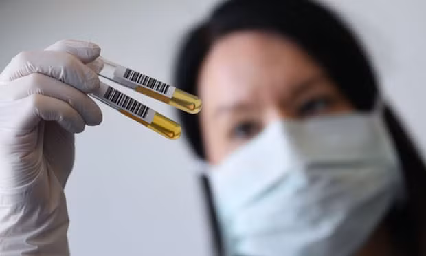 A researcher from University Hospital Erlangen, Germany, which has been granted permission to produce therapeutic plasma to treat critically ill Covid-19 patients. Photograph: Andreas Gebert/Reuters