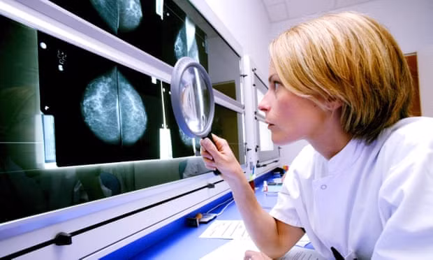 A radiologist examines mammograms on a lightbox with a magnifier. Photograph: REX/Shutterstock