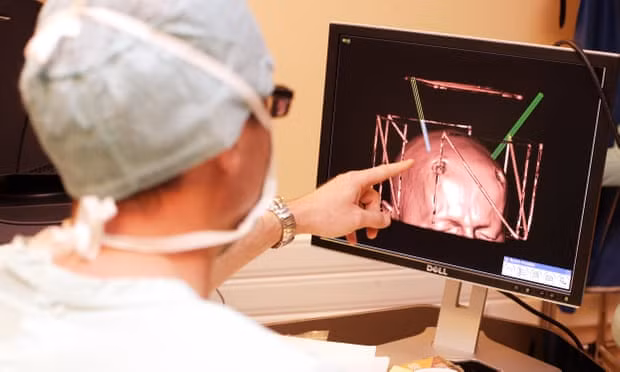 A patient with Parkinson’s disease is treated with thalamic stimulation, with electrodes inserted into the brain. Photograph: Alamy