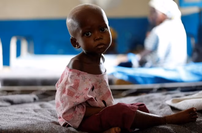Ntumbabu Kalubi, 4, an internally displaced and severely acute malnourished child waits to receive medical attention at the Tshiamala general referral hospital of Mwene Ditu in Kasai Oriental Province in the Democratic Republic of Congo, March 15, 2018. REUTERS/Thomas Mukoya