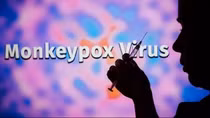 No monkeypox cases recorded in Vietnam so far